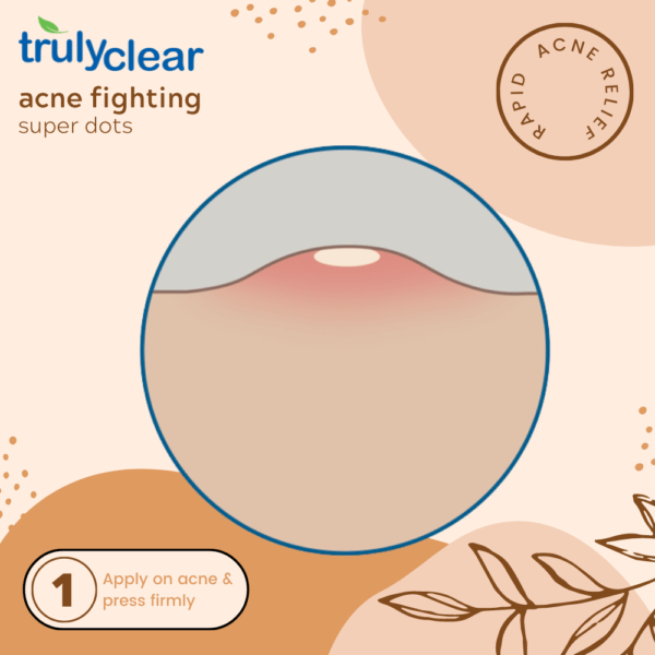 3 Truly Clear acne patch <h6>This bundle includes our most favorite products.</h6> <ul> <li>1 Truly Clear Bar</li> <li>72 Truly Clear Acne Patches</li> <li>10 Truly Clear Zone Patches</li> <li>4 Truly Clear Cleansing Pads</li> </ul>