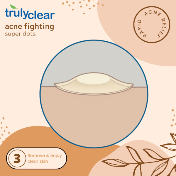 5 Truly Clear acne patch <h6>This bundle includes our most favorite products.</h6> <ul> <li>1 Truly Clear Bar</li> <li>72 Truly Clear Acne Patches</li> <li>10 Truly Clear Zone Patches</li> <li>4 Truly Clear Cleansing Pads</li> </ul>